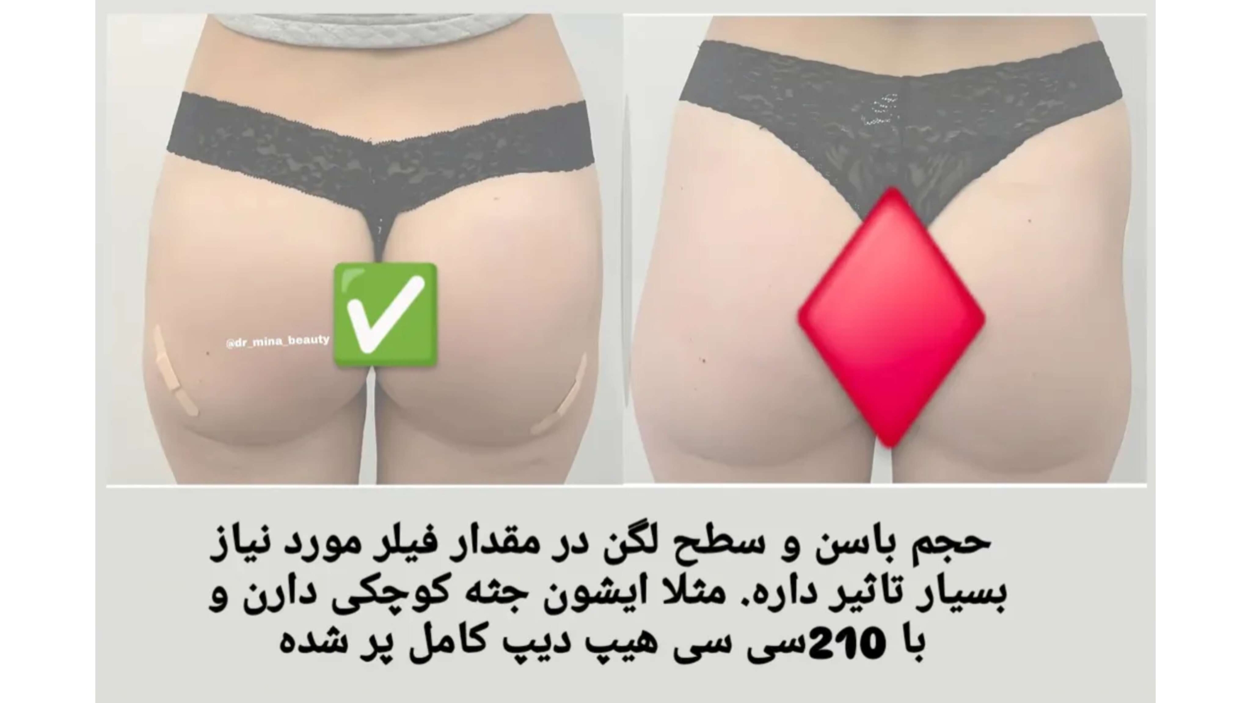 new image