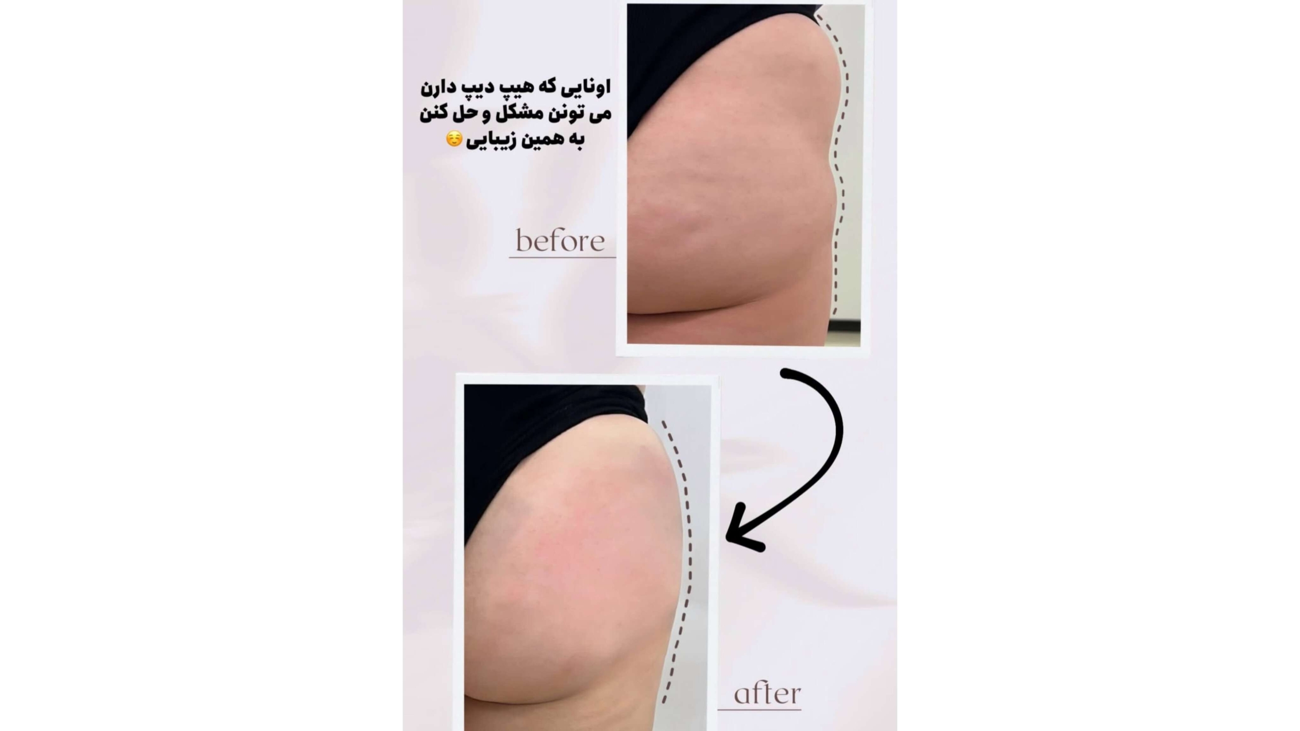 new image